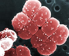 Deinococcus radiodurans