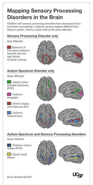 sensory issues in adults sensory issues in adults
