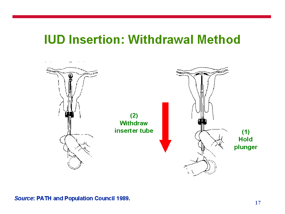 how effective is the withdrawal method how effective is the withdrawal method
