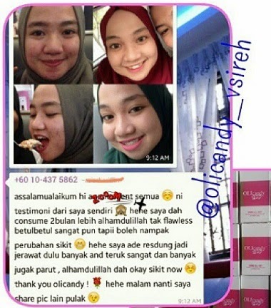 OLICANDY KULIT BEBAS JERAWAT DAN PARUT, LEBIH CERAH BERSERI TESTIMONI OLICANDY KULIT AWET MUDA