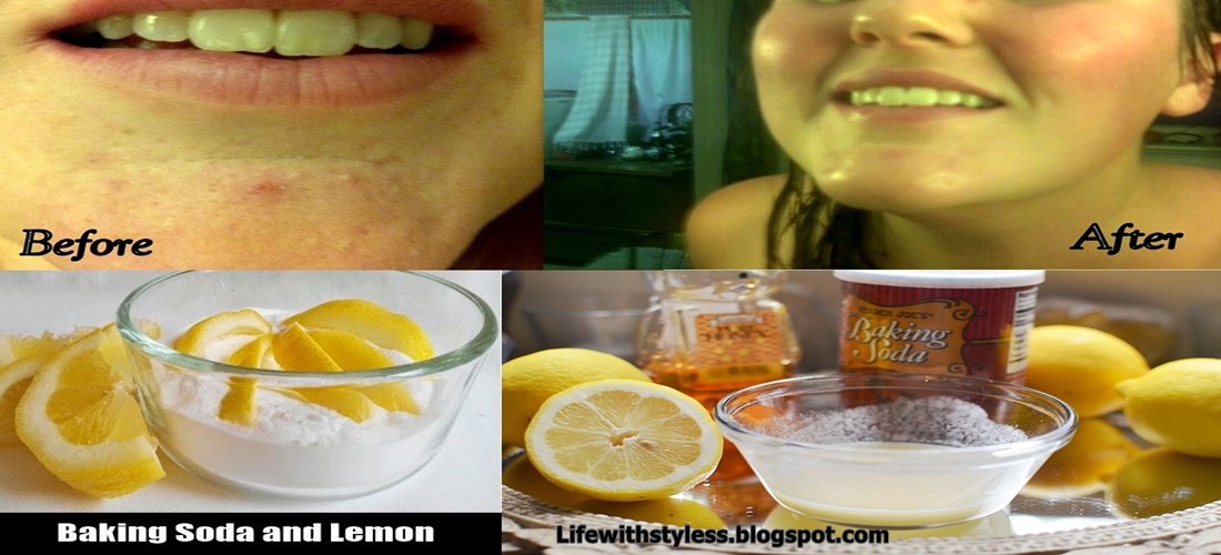 BAKING SODA & LEMON Complete Skin Care Ingredients DIY FACE MASK