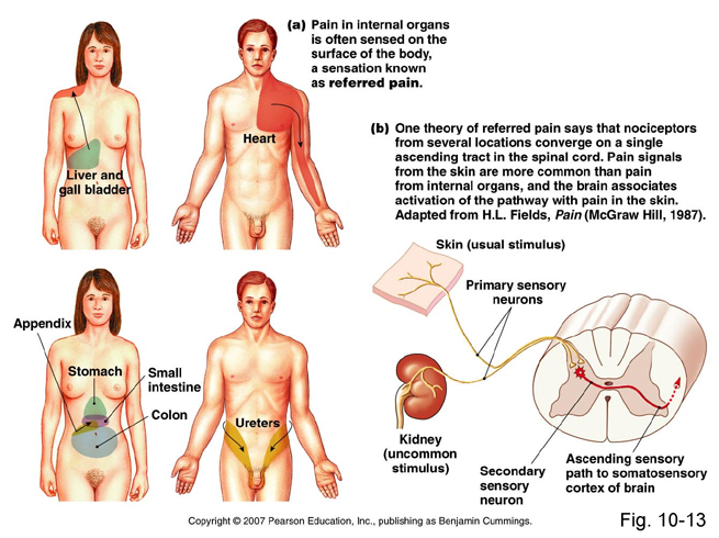 Medicalsham Referred Pain