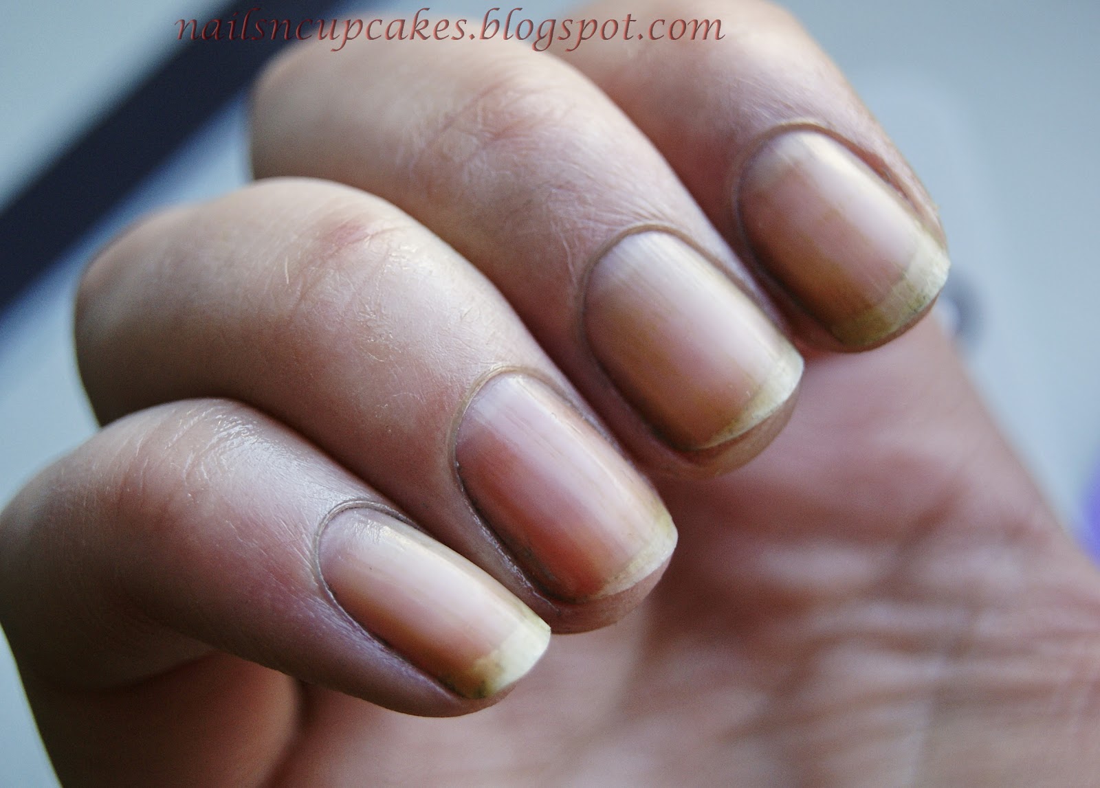 NailsN'cupcakes Guide to get rid of ridges and yellow nails!