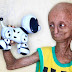 Why does this 14 years old boy looks like an elderly man? Read the story and find out why!