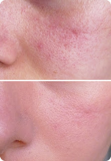 BB Cream Hydreane La Roche Posay Swatch BB Cream Hydreane La Roche Posay Swatch