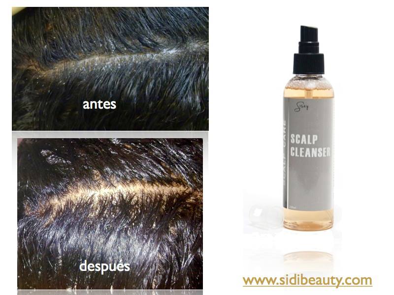 Sidi Beauty Blog de Belleza Peeling Capilar para un cabello sano