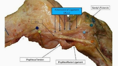 Ligamento anterolateral en imagen real BieneSaludAlgoM Ligamento