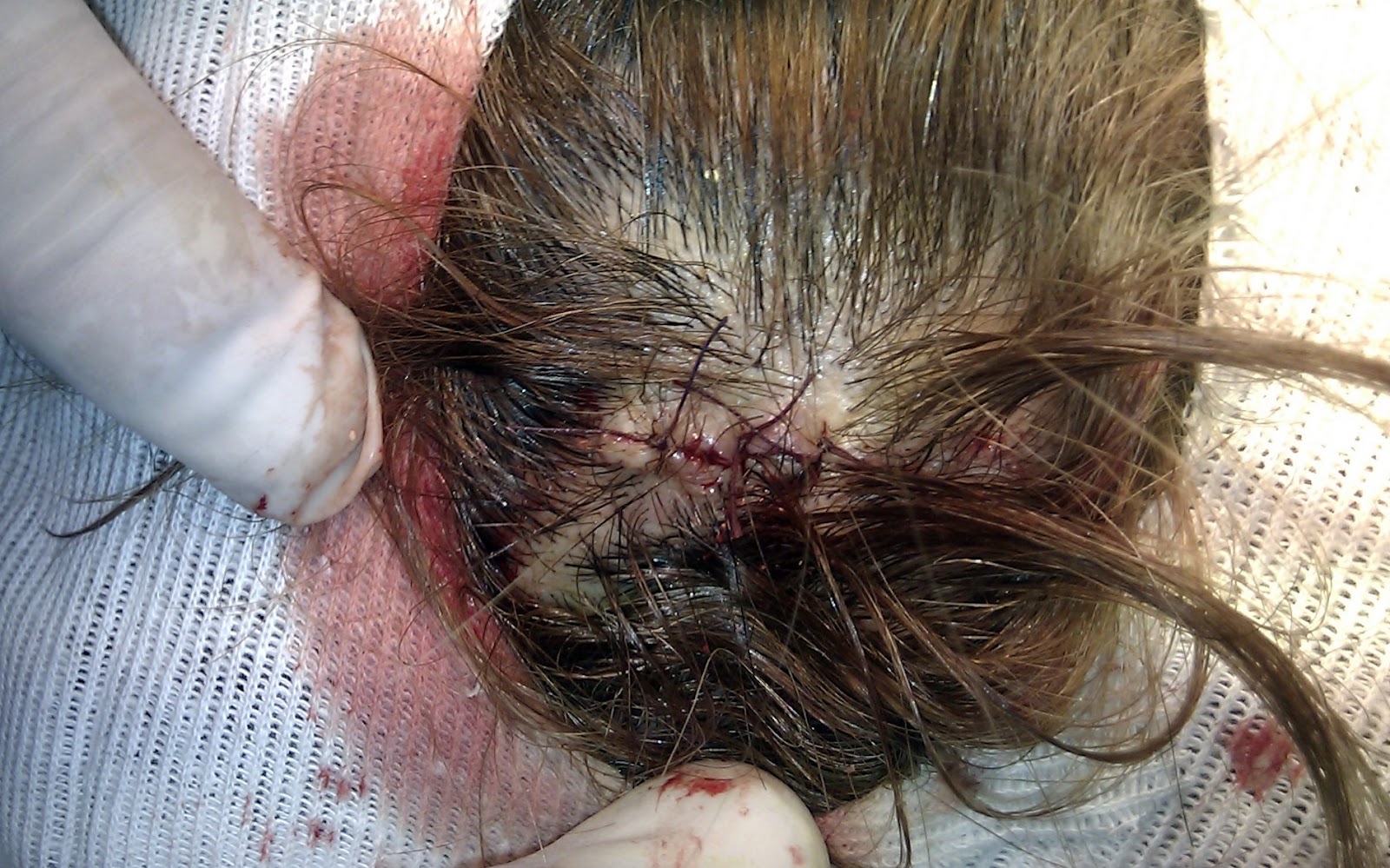 Importante que trucos para quemar grasa dela barriga cada zona dividi Trucos para quemar grasa dela barriga tiene resultados