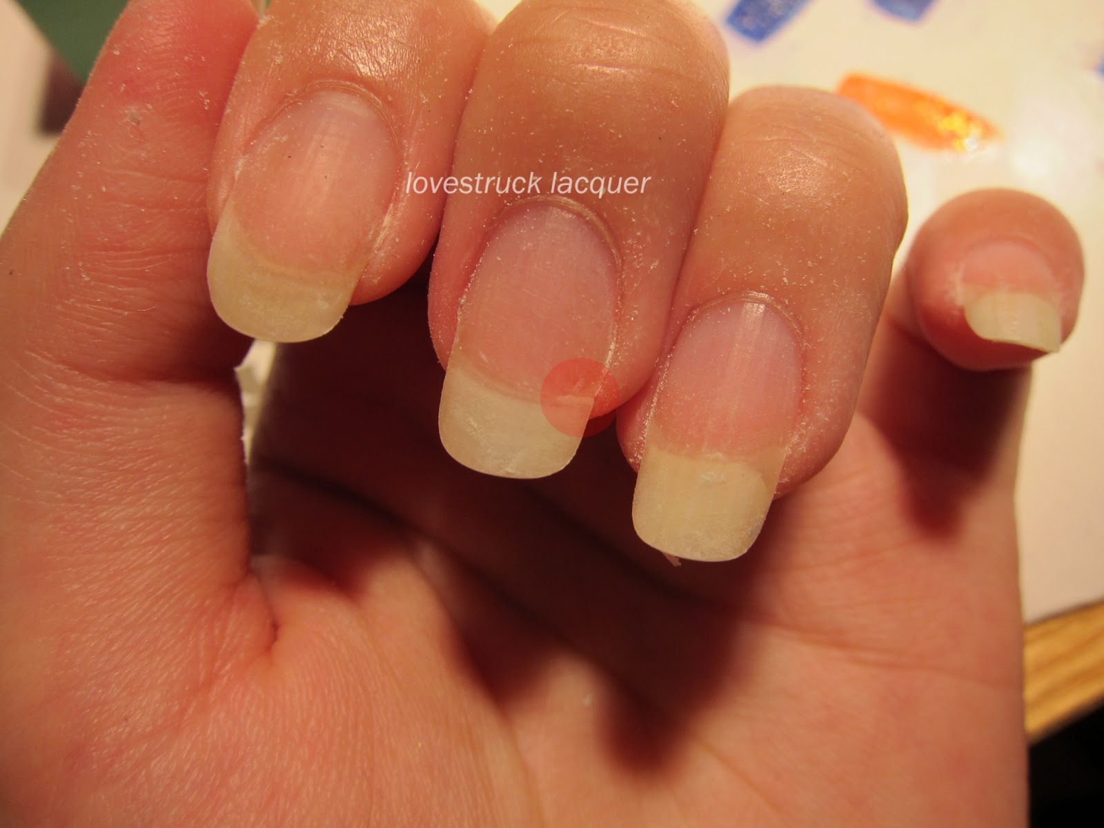 Lovestruck Lacquer Supernail Nail Bandage review