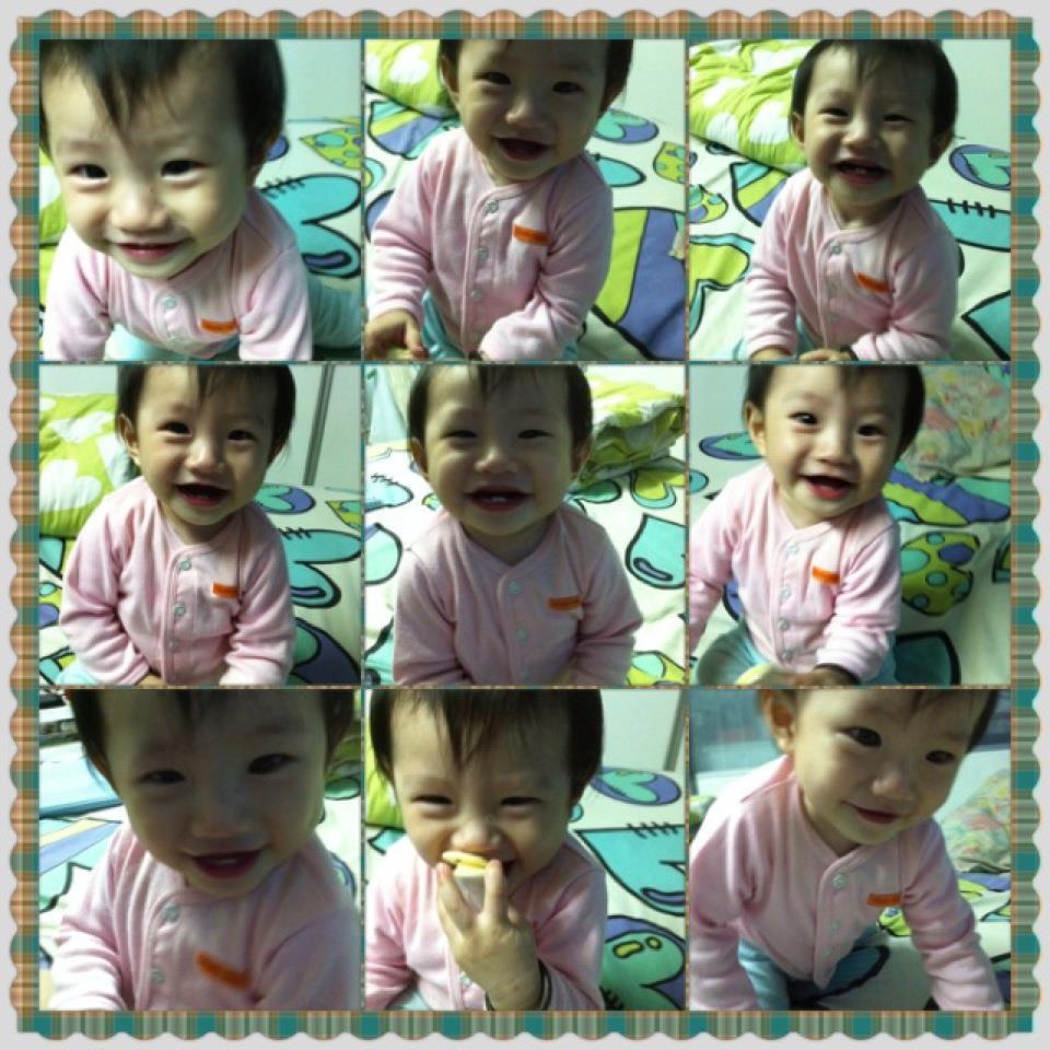 Tragis! Seorang bayi terkena Stroke diumur 1 tahun yew yew