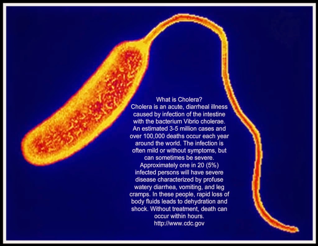 the microbiology of the vibrio cholerae bacterium Vibrio cholerae - vibrio cholerae asiatic or epidemic cholera page 360 readings question #1 describe the vibrio cholerae bacterium where is it found cholera leads to watery diarrhoea, loss of fluids and electrolytes and rapid dehydration it is caused by the bacterium vibrio cholera the genus vibrio, campylobacter and associated. the microbiology of the vibrio cholerae bacterium Vibrio cholerae - vibrio cholerae asiatic or epidemic cholera page 360 readings question #1 describe the vibrio cholerae bacterium where is it found cholera leads to watery diarrhoea, loss of fluids and electrolytes and rapid dehydration it is caused by the bacterium vibrio cholera the genus vibrio, campylobacter and associated.