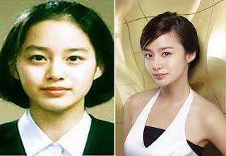 Kim Tae Hee Plastic Surgery before and after