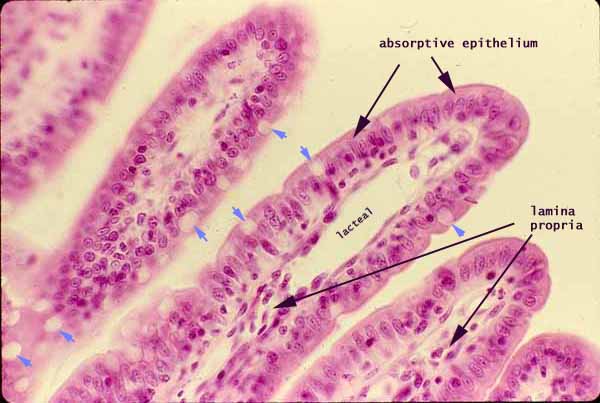 Beta Blog: Computer chip analyses effect of food on intestines
