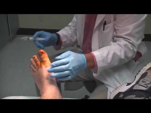 Permanently remove toenail infected . Signs of infection include ache,