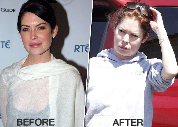 lara-flynn-boyle_plastic-surgery_before-and-after.jpg