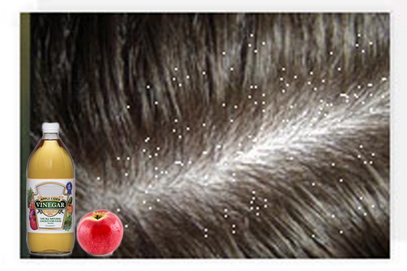 dandruff trouble dandruff trouble caring tips for dandruff trouble dandruff trouble caring tips for