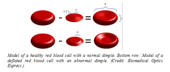 rbc morphology