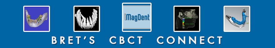 Bret's CBCT Connect