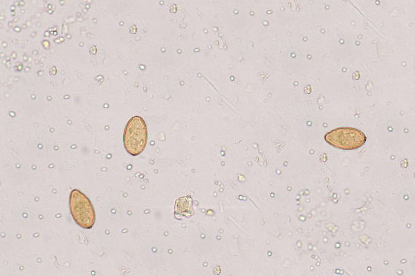 Parasite+Eggs+In+Human+Stool Medical Laboratory and Biomedical Science: Parasites in human faeces