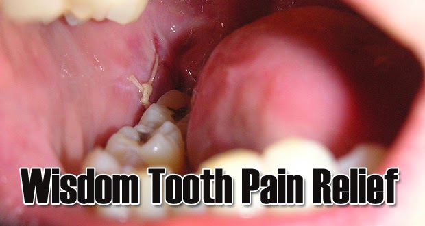 home remedies for sore wisdom teeth