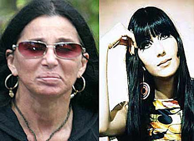 cher before surgery plastic breast bad nose job implants 24h