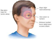 7 symptoms of migraine 7 symptoms of migraine