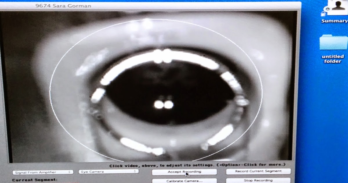 ERG test Advancements in eye exams to test for plaquenil toxitity right around the corner!