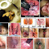 Obat Wasir: Shu Zhi Wan, AmbeJOSS, Mediven thumbnail