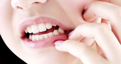 Cara Meredakan Sakit Gigi dengan Cepat