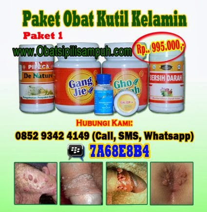 kutil kelamin, kutil di kemaluan, obat kutil kelamin, obat kutil di kemaluan