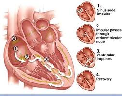 What Is Bradycardia
