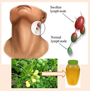 Manfaat Antibodi Monoklonal Dalam Minyak Biji Jarak Sebagai Obat Kanker Getah Bening Gb. Manfaat Antibodi Monoklonal Dalam Minyak Biji Jarak Sebagai Obat Kanker Getah Bening