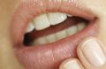 Tratament herpes