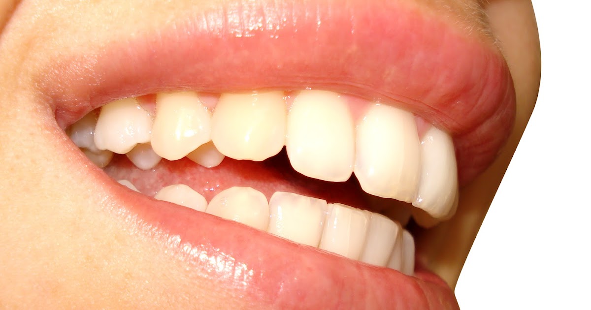 COMENCASA365 DIENTES