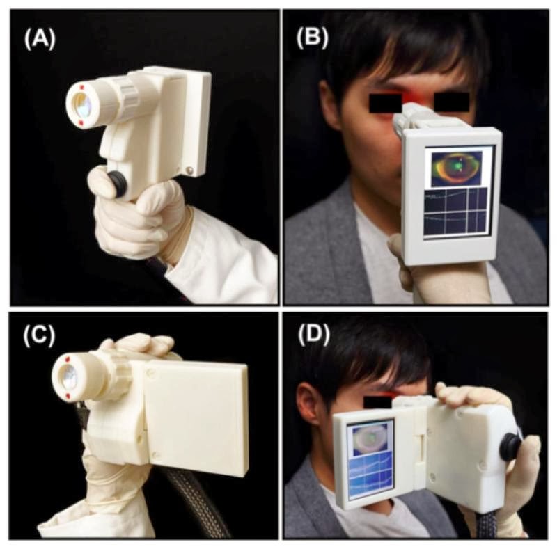 Optical Coherence Tomography (OCT) A new optical device to scan eye