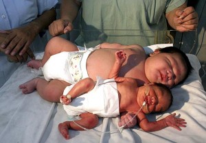 Worlds Biggest Baby At Birth Images & Pictures - Becuo Worlds Biggest Baby At Birth Images & Pictures - Becuo