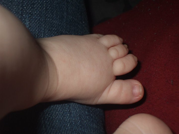 A Beautiful Life So, what is Down Syndrome?