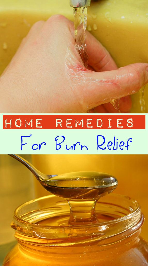 Surprising Home Remedies for Burns How to Treat a Burn