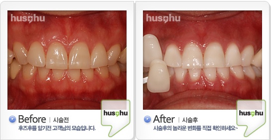 Order Doxycycline Teeth