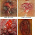 Jual Obat Wasir Ardium Ambeclear Alami Tanpa Operasi thumbnail