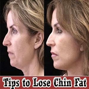 Diet to lose chin fat yahoo