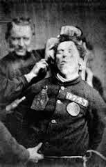 Post Traumatic Stress Disorder and the American Civil War - National Museum  of Civil War Medicine