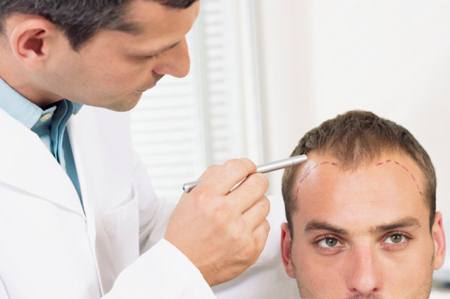 Whereismydoctor Com Hair Transplant Surgery Not Recommended For