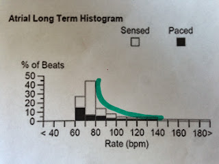 Pacemaker Histogram Pacemaker Histogram