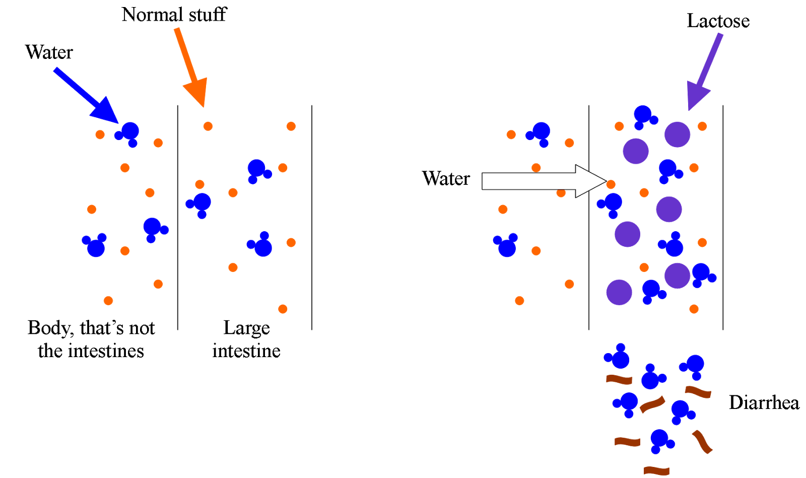 Sickness is Fascinating Lactose Intolerance