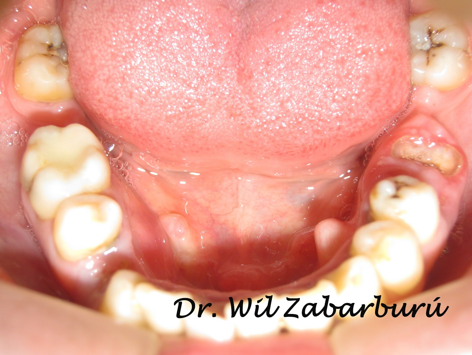 CLINICA DENTAL ASISTENCIAL EXOSTOSIS