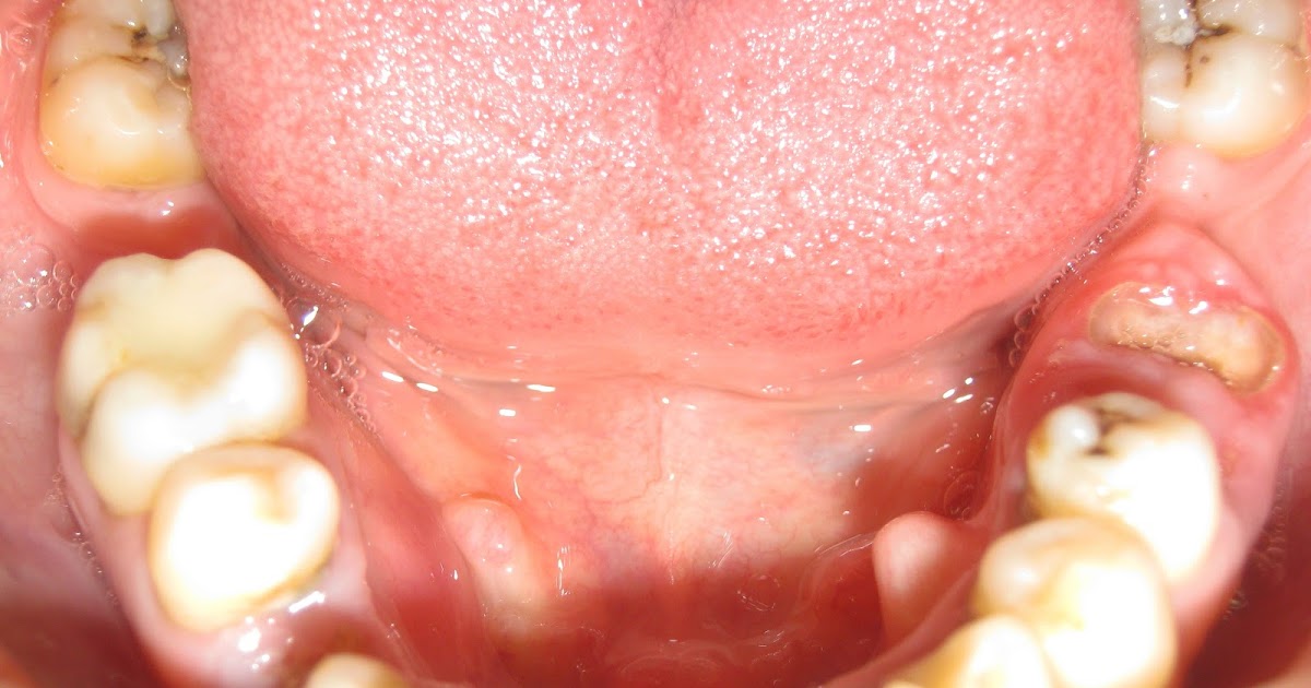 CLINICA DENTAL ASISTENCIAL EXOSTOSIS