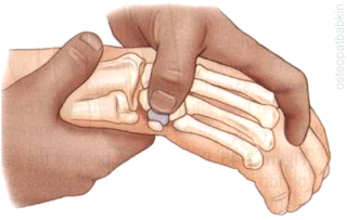 С крючковидной кости мы можем снова перейти проксимально и немного ульнарно и оказаться над трехгранной костью.