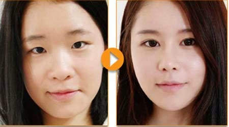 [Image: nang-mui-8.jpg]