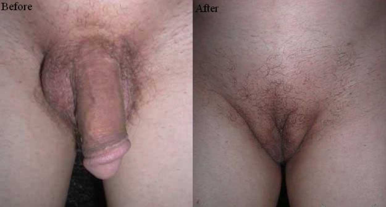 Shaved penis and vagina